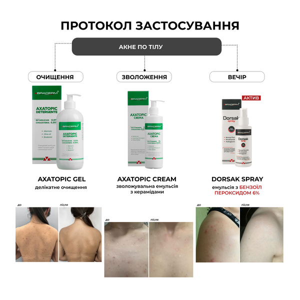 Braderm Dorsak Spray | Активний протизапальний спрей з Бензоїл пероксидом 6% 986003484 фото