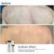 Braderm Dorsak Spray | Активний протизапальний спрей з Бензоїл пероксидом 6% 986003484 фото 3
