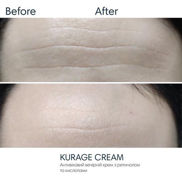 Braderm Kurage Cream | Крем-пілінг з ретинолом та кислотами 813860815 фото