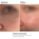 Braderm Kurac Mousse | Ніжна пінка для вмивання з пребіотиками 304154881 фото 2