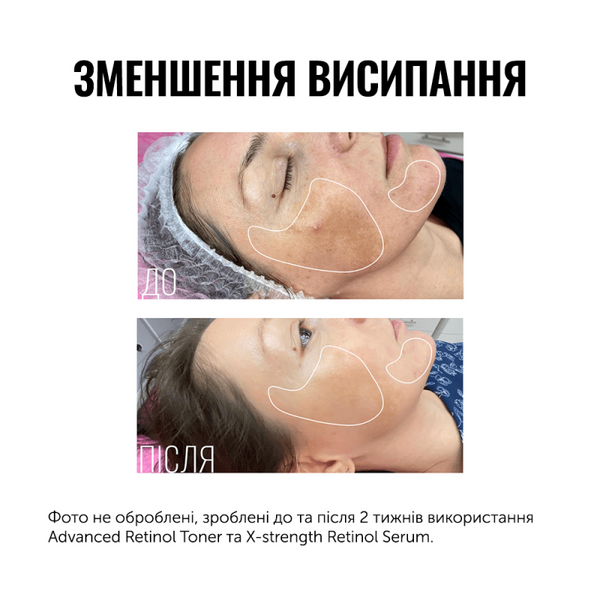 INSTYTUTUM ТОНЕР З РЕТИНОЛОМ ADVANCED RETINOL TONER ІНТЕНСИВНИЙ ВІДНОВЛЮВАЛЬНИЙ ТОНЕР З РЕТИНОЛОМ 060606 фото