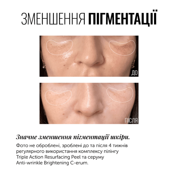 INSTYTUTUM  СИРОВАТКА З ВІТАМІНОМ С ANTI-WRINKLE BRIGHTENING C-ERUM СУПЕРКОНЦЕНТРОВАНИЙ СЕРУМ З ВІТАМІНОМ С (15% THD) 040404 фото