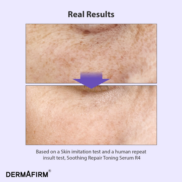 Dermafirm Soothing Repair Toning Serum R4 | Мультифункціональна сироватка з бакучіолом 00-00000667 фото