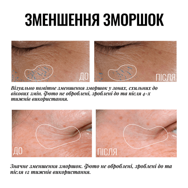 INSTYTUTUM КРЕМ НАВКОЛО ОЧЕЙ TRULY-TRANSFORMING BRIGHTENING EYE CREAM КРЕМ-ЛІФТИНГ ДЛЯ ПОВІК З ОСВІТЛЮВАЛЬНИМ ЕФЕКТОМ. ДЛЯ ВИКОРИСТАННЯ ВРАНЦІ ТА ВВЕЧЕРІ. 0060060006 фото