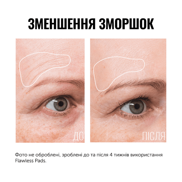 INSTYTUTUM ПІЛІНГ-ПАДИ FLAWLESS PADS ПАДИ (ДИСКИ) З КИСЛОТАМИ ДЛЯ ГЛИБОКОГО ВІДНОВЛЕННЯ ШКІРИ 00100101 фото