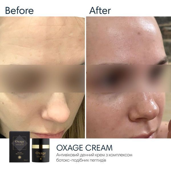 Braderm Oxage Cream | Aнтивіковий крем 820716320 фото