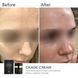 Braderm Oxage Cream | Aнтивіковий крем 820716320 фото 2