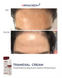 Braderm Tramexal Cream | Освітлюючий крем проти пігментації 971213669 фото 4