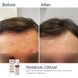 Braderm Tramexal Cream | Освітлюючий крем проти пігментації 971213669 фото 2