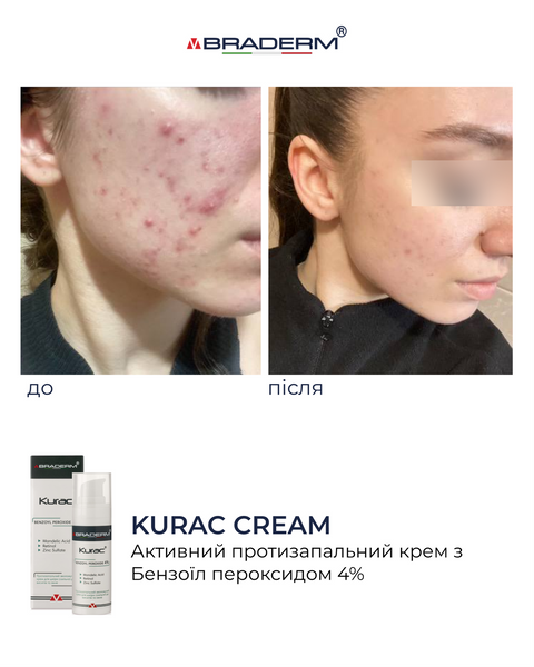 Braderm Kurac Cream | Активний протизапальний крем з бензоїл пероксидом 4% 106356892 фото