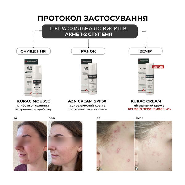Braderm Kurac Cream | Активний протизапальний крем з бензоїл пероксидом 4% 106356892 фото