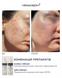 Braderm Kurac Cream | Активний протизапальний крем з бензоїл пероксидом 4% 106356892 фото 2