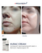 Braderm Kurac Cream | Активний протизапальний крем з бензоїл пероксидом 4% 106356892 фото 4