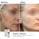 Braderm Kurac Cream | Активний протизапальний крем з бензоїл пероксидом 4% 106356892 фото 5