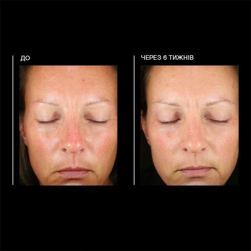 PCA SKIN Hyaluronic Acid Overnight Mask зволожуюча маска 64792663 фото